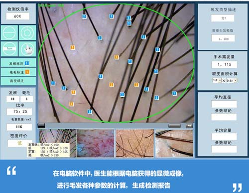 头发加密需要多少钱